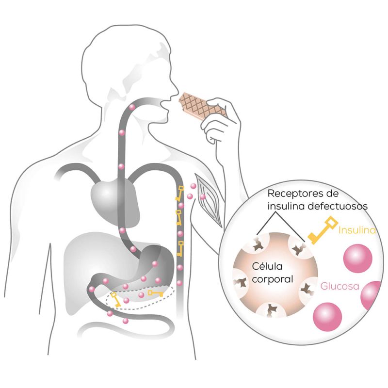 Ilustración de Beurer sobre la glucosa en sangre: principio de la diabetes tipo 2